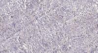 Plasminogen receptor Polyclonal Antibody