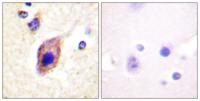 PLC γ2 Polyclonal Antibody