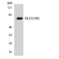 OATP-C Polyclonal Antibody