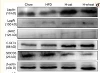 Ob-R Polyclonal Antibody