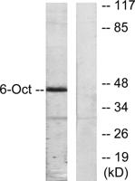 Oct-6 Polyclonal Antibody