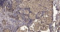 MEK-7 Polyclonal Antibody