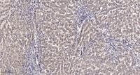 MerTK Polyclonal Antibody