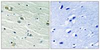 MerTK/Tyro3 Polyclonal Antibody