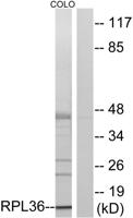 Ribosomal Protein L36 Polyclonal Antibody