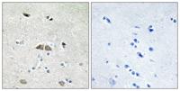 Ribosomal Protein L39L Polyclonal Antibody