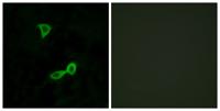 mGluR2 Polyclonal Antibody