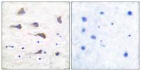 mGluR-6 Polyclonal Antibody