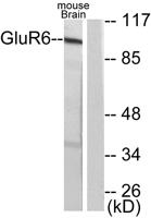 mGluR-6 Polyclonal Antibody