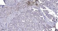 mGluR7 Polyclonal Antibody