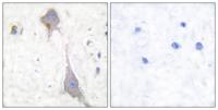 mGluR-7 Polyclonal Antibody