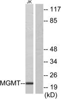 MGMT Polyclonal Antibody