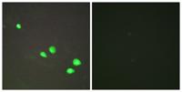 Mi2-β Polyclonal Antibody