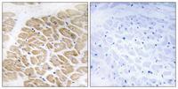 MIA Polyclonal Antibody