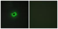 MIC2 Polyclonal Antibody