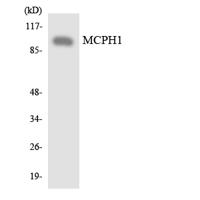 Microcephalin Polyclonal Antibody