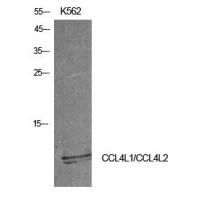 MIP-1b Polyclonal Antibody