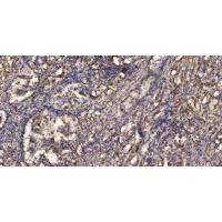 MIP-1b Polyclonal Antibody