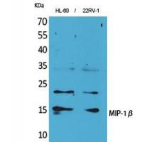 MIP-1β Polyclonal Antibody