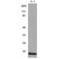 MIP-1β Polyclonal Antibody