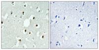 MLH3 Polyclonal Antibody