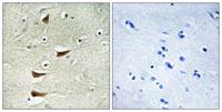 MLK2 Polyclonal Antibody