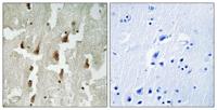 MNDA Polyclonal Antibody