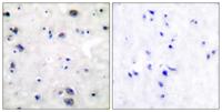 MOR-1 Polyclonal Antibody