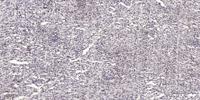 MOV10L1 Polyclonal Antibody