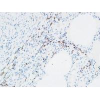 MPO Polyclonal Antibody