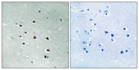 MRE11 Polyclonal Antibody
