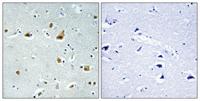 Ribosomal Protein L5 Polyclonal Antibody