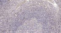 Ribosomal Protein L7L1 Polyclonal Antibody