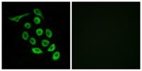 Ribosomal Protein S12 Polyclonal Antibody