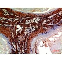ADAMTS-18 Polyclonal Antibody
