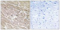 MRP-L46 Polyclonal Antibody