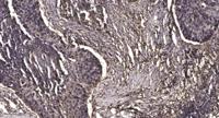 MRP-L47 Polyclonal Antibody