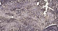 MRP-L9 Polyclonal Antibody