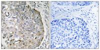 MRRF Polyclonal Antibody