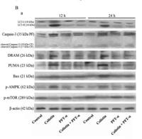 mTOR Polyclonal Antibody