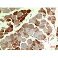 MYH-pan Polyclonal Antibody