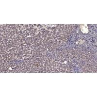 MyoD Polyclonal Antibody
