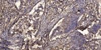 Myosin XVI Polyclonal Antibody