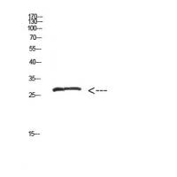 MYOZ2 Polyclonal Antibody