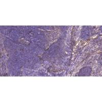MYOZ2 Polyclonal Antibody