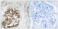 Myt 1 Polyclonal Antibody