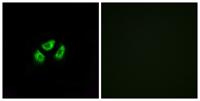 Na+ CP type VIIα Polyclonal Antibody