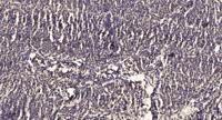Na+/K+-ATPase α2 Polyclonal Antibody