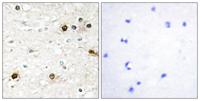 NAB2 Polyclonal Antibody