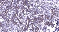 NACAD Polyclonal Antibody